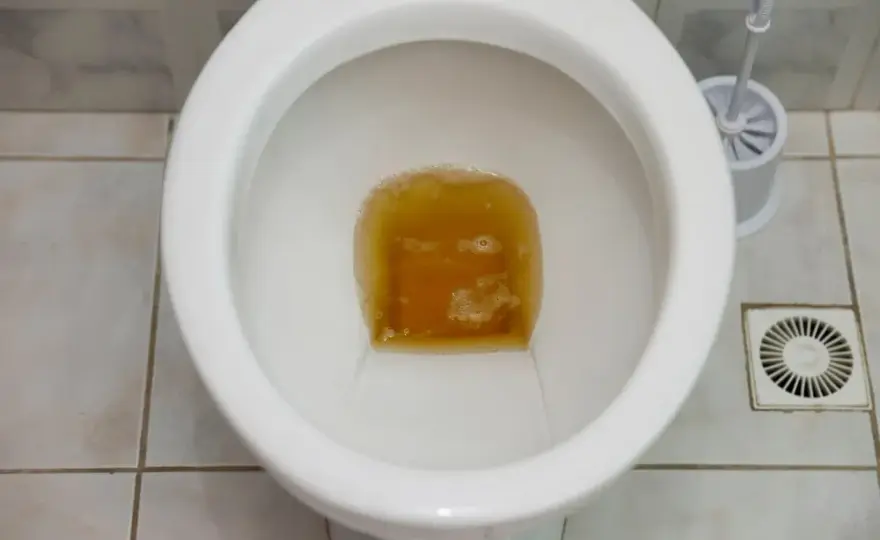 Przyczyny bardzo ciemnego moczu i co oznacza jego kolor?