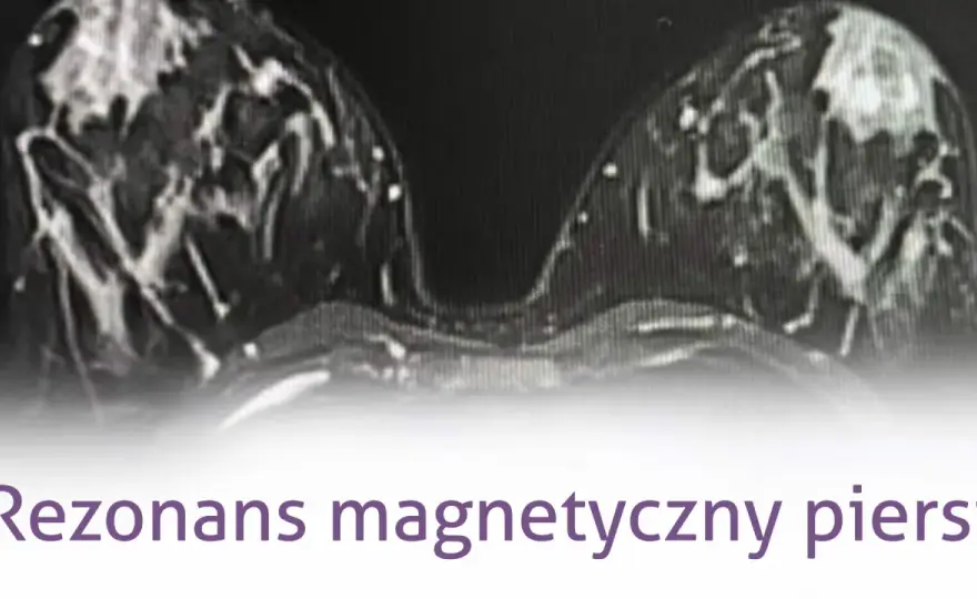 Mammografia czy rezonans - która metoda diagnozy raka piersi jest lepsza?