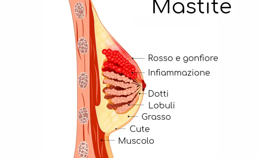 Dolore al seno durante l’allattamento? Cause e rimedi utili