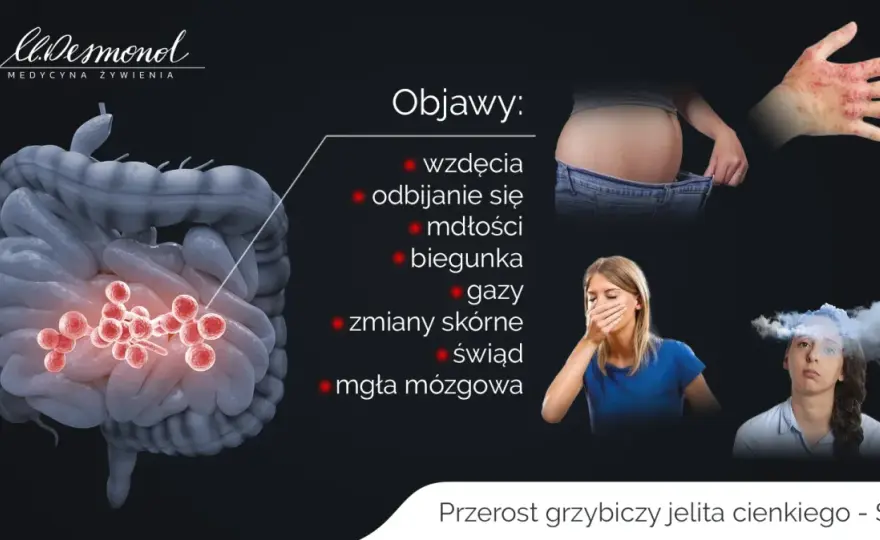 Grzybica jelit - Objawy, diagnostyka i co naprawdę działa?
