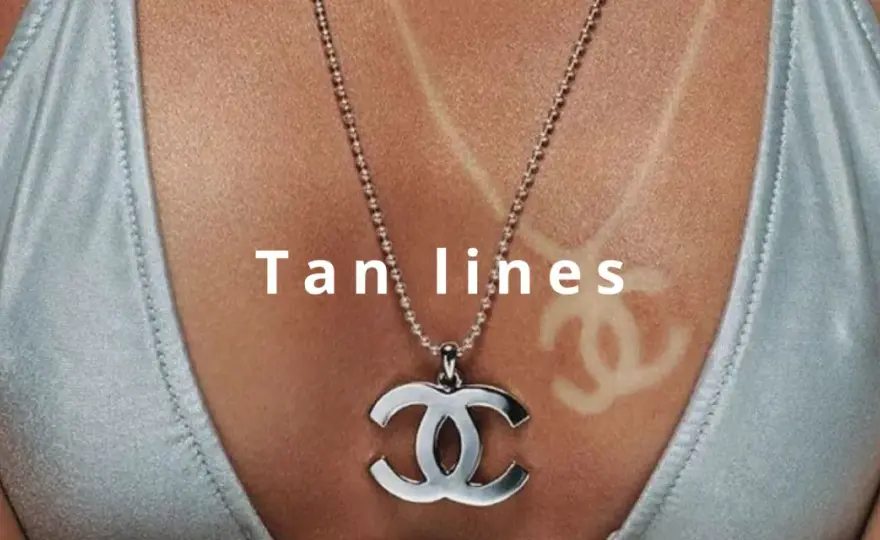 Segno del costume in inglese - si dice tan line?