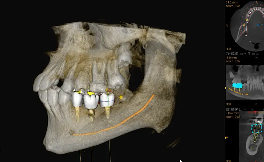 CBCT w stomatologii - Kiedy tomografia stożkowa ma sens?
