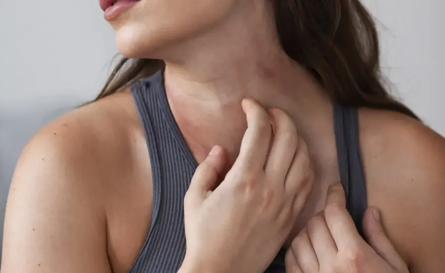 Sarpullido en el cuello - causas, cuidados y cuándo consultar