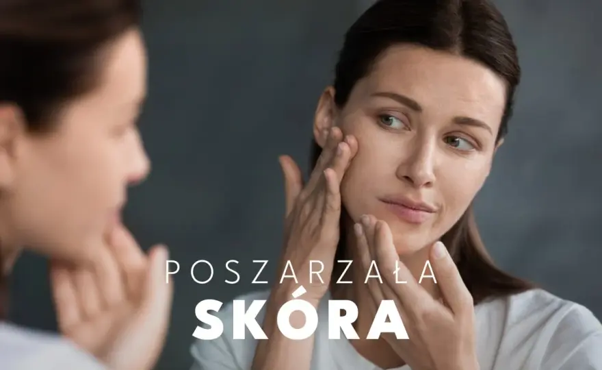 Dull skin, czyli szara cera - jak przywrócić jej blask?