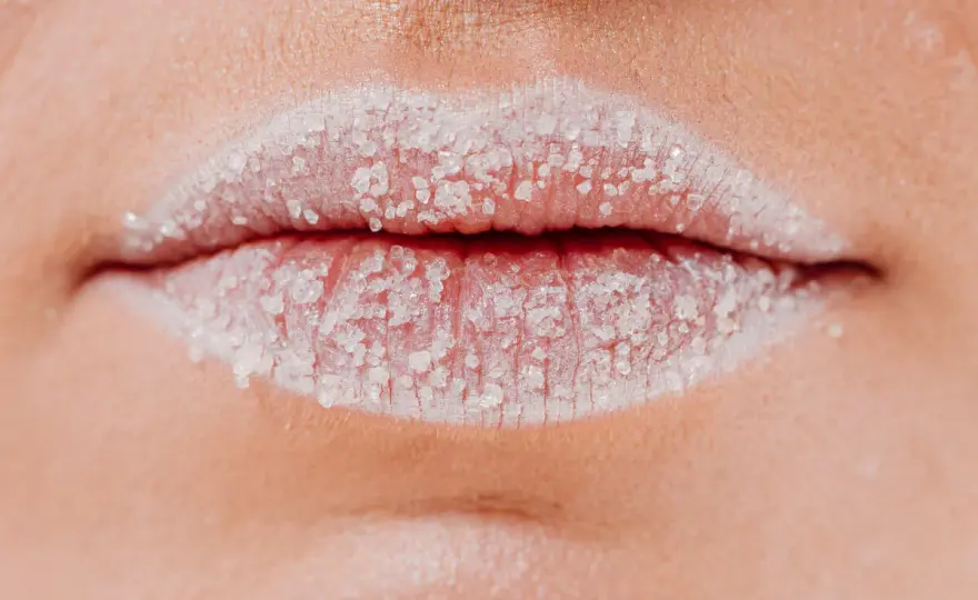 ¿Por qué tengo los labios blancos y cuándo consultar?
