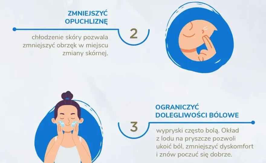 Pryszcz na twarzy - Szybko i bez śladu? Sprawdź plan!