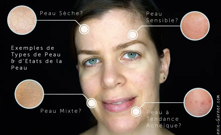 Comment savoir si vous avez vraiment la peau grasse ?