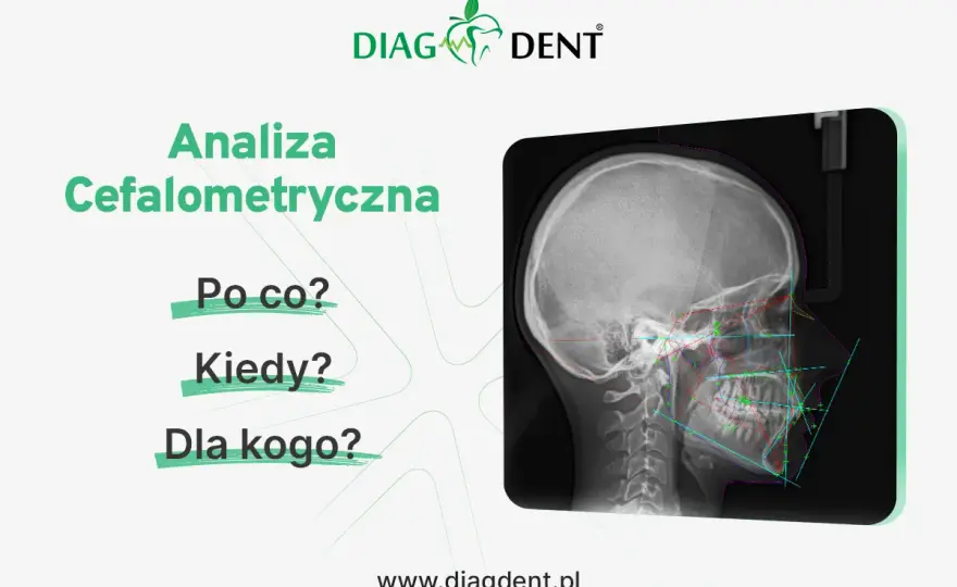 Cefalometria w ortodoncji - co pokazuje i kiedy ma sens