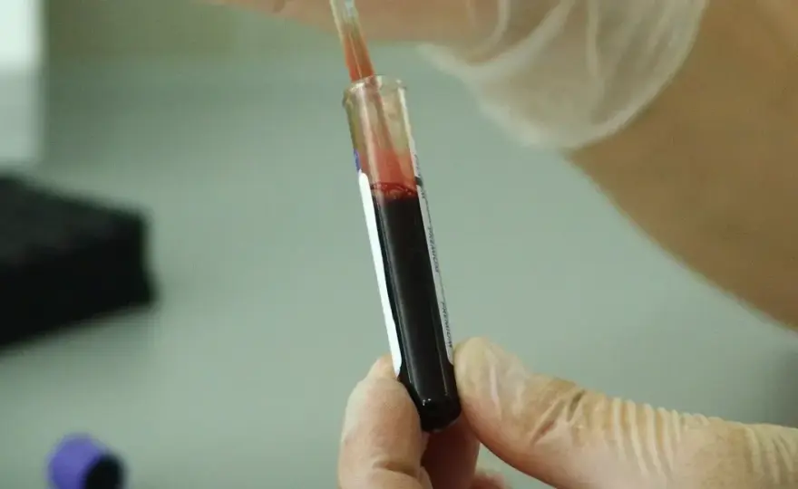 Czy leki na HIV są refundowane? Sprawdź, co musisz wiedzieć o dostępności
