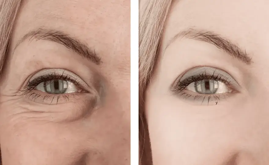 Retinol - efekty przed i po: kiedy widać różnicę?