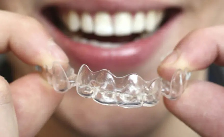 ¿Cuánto dura un tratamiento con alineadores transparentes?