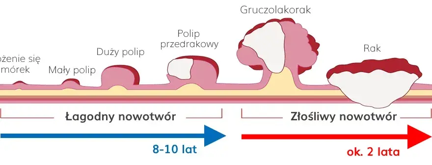 Stolec przy raku jelita grubego: kluczowe zmiany i objawy