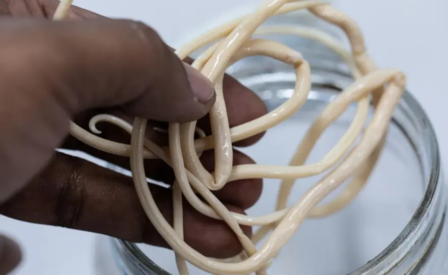 Ossiuri nei bambini - sintomi, scotch test e prevenzione