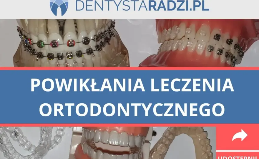 Ból zębów po zdjęciu aparatu - Kiedy do ortodonty?