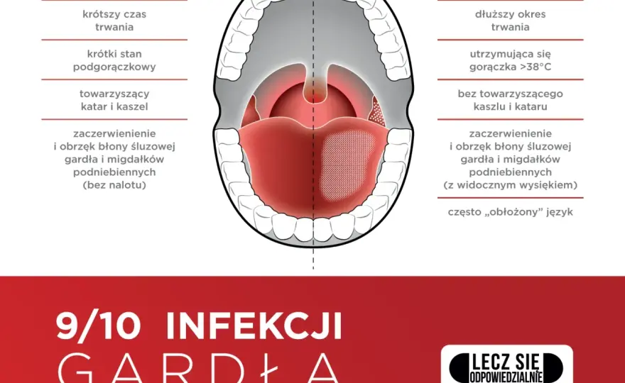 Najczęstsze objawy zapalenia gardła: 7 niepokojących sygnałów choroby