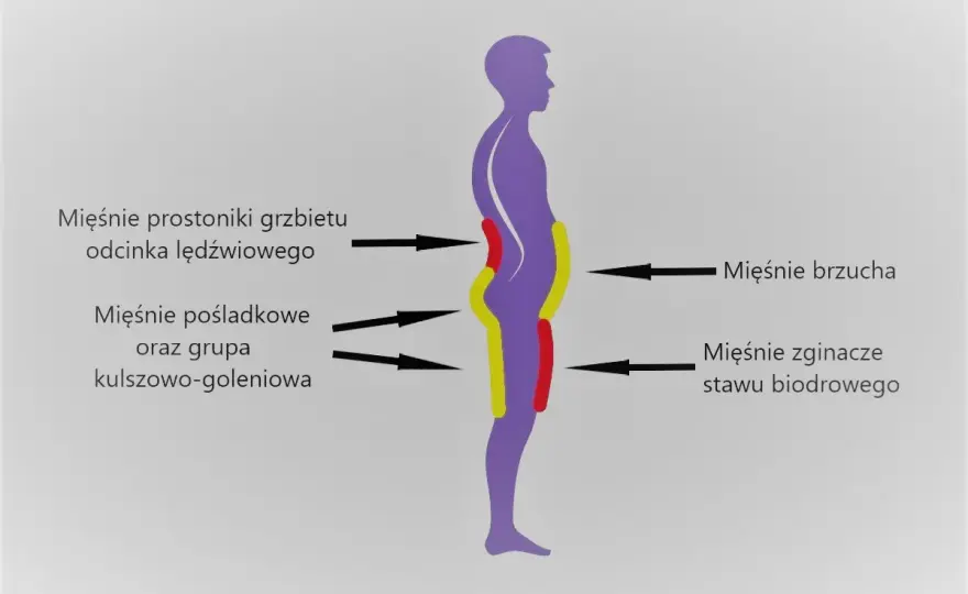 Lordoza lędźwiowa - Kiedy jest problemem i jak ją leczyć?