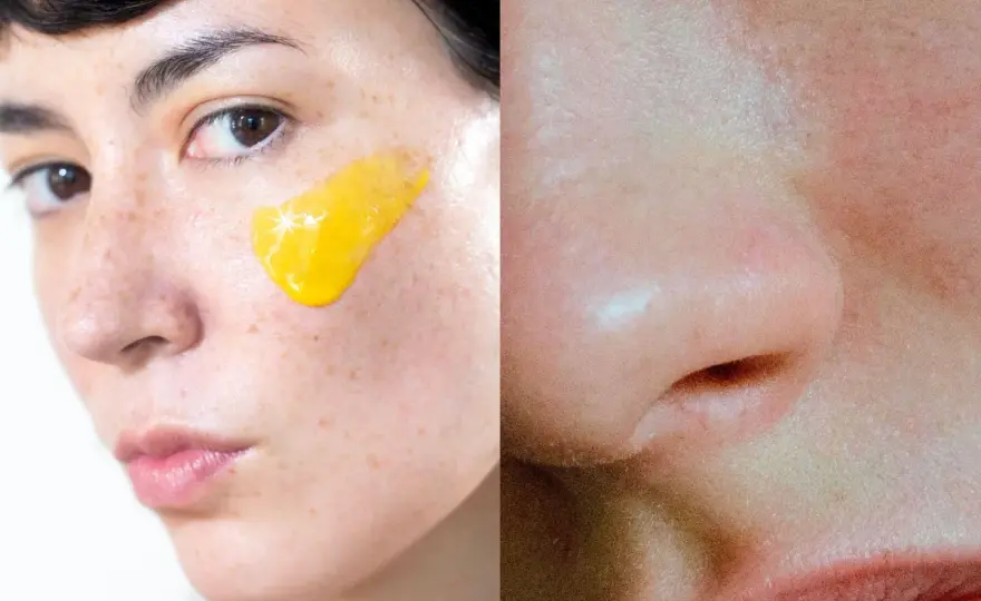 Retinol och rosacea - När är det säkert att använda?