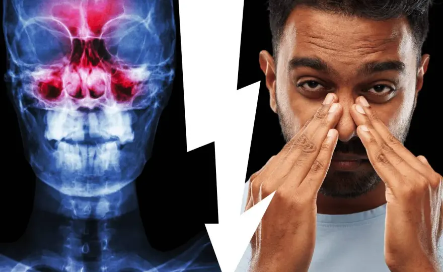 Seno mascellare e denti - La guida per capire il dolore