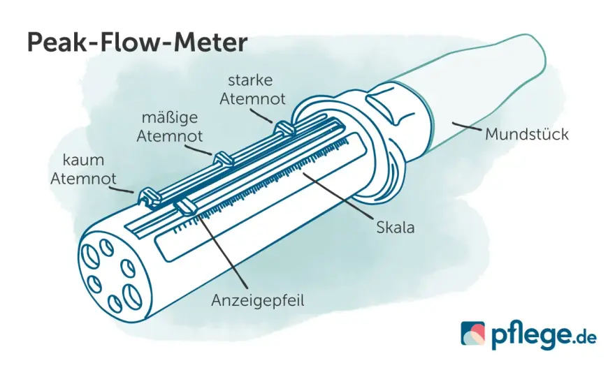 COPD Gold 3 und GdB - welcher Wert ist realistisch?