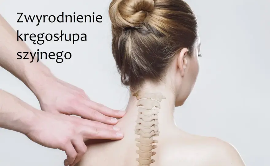 Leki na zwyrodnienie kręgosłupa szyjnego - co naprawdę działa?