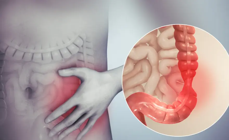 Objawy jelita drażliwego: co mówią jelita? Czerwone flagi IBS