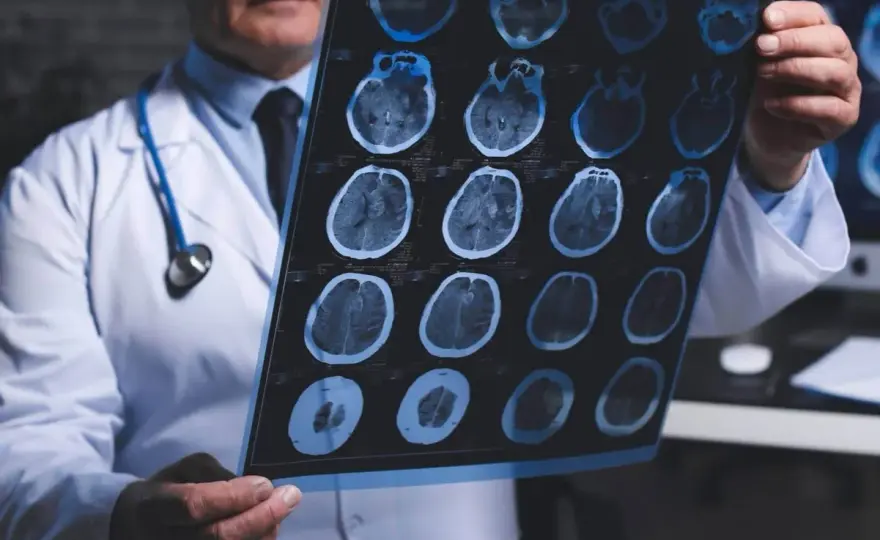 Neurolog od czego zacząć? Objawy, które mogą zaskoczyć