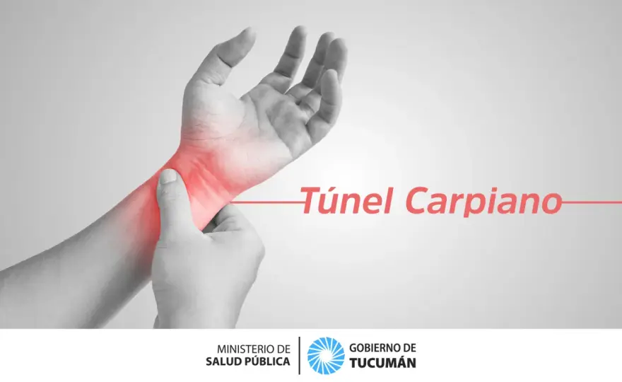 Túnel Carpiano - ¿Hormigueo en la mano? Entiende y actúa