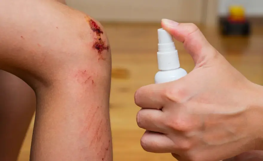Points de suture - faut-il les couvrir ou les laisser à l’air libre ?
