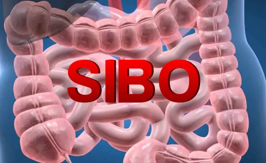 SIBO: przerost flory bakteryjnej i jego skutki dla zdrowia.