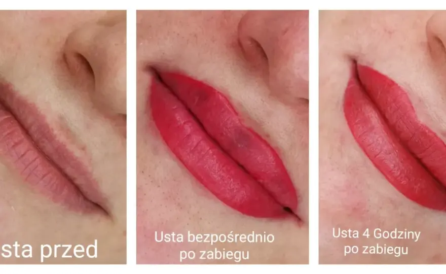 Usta po makijażu permanentnym dzień po dniu - Jak wygląda gojenie?