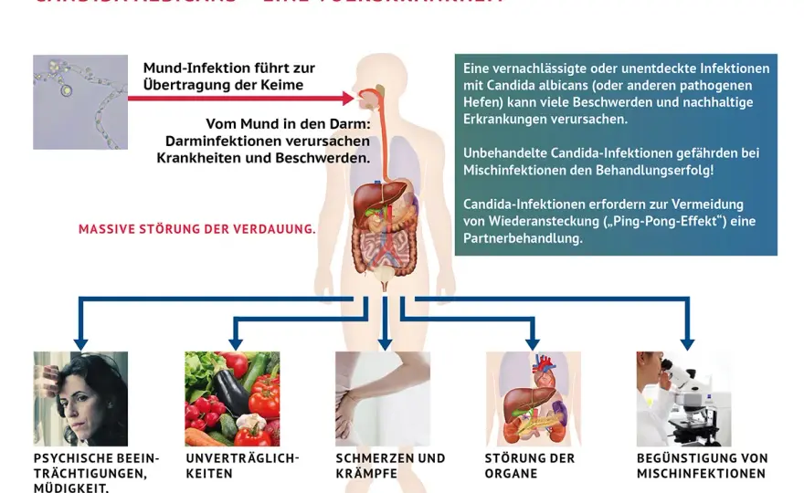 Candida-Behandlung - Symptome, Nebenwirkungen oder Warnsignal?