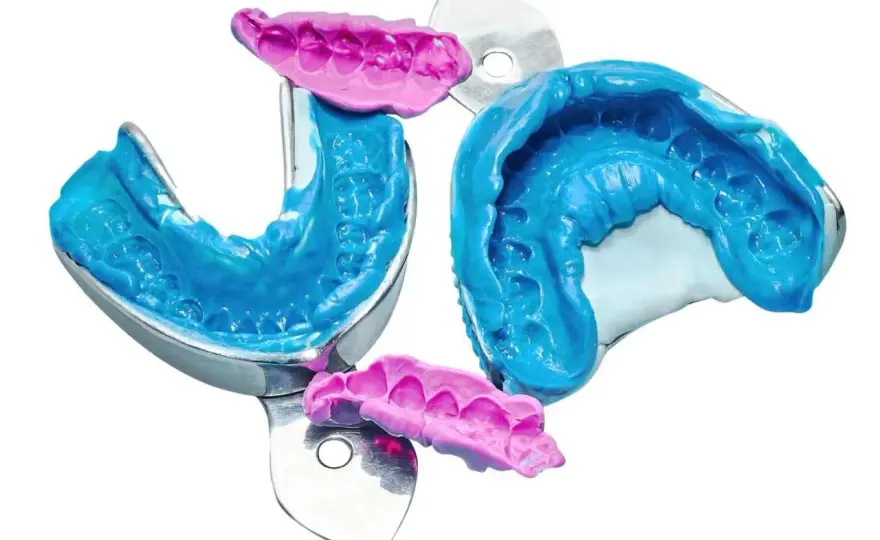 Impronta dentale, tradizionale o digitale? Come si sceglie