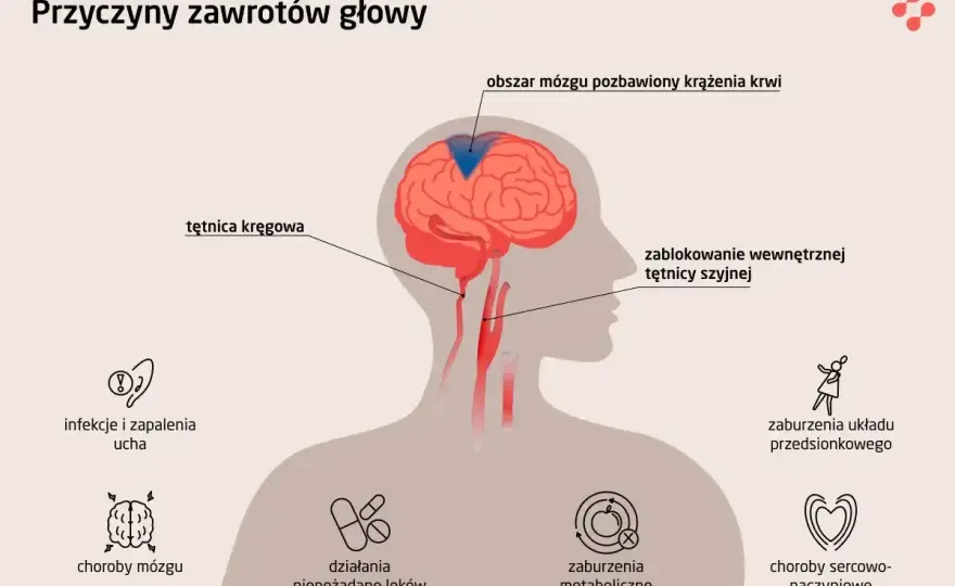 Błędnik - Przyczyny zawrotów głowy, objawy i leczenie