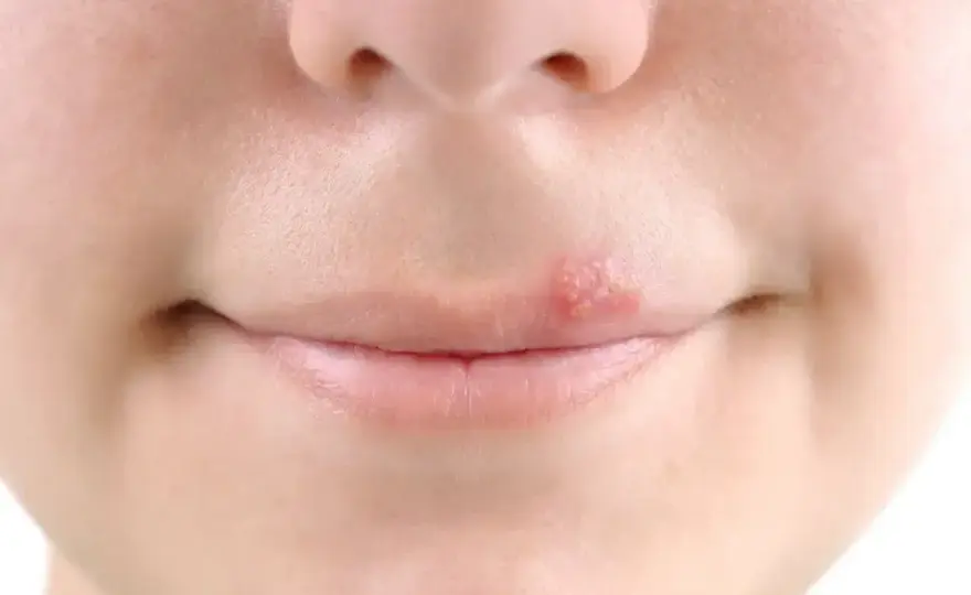 Spuchnięte usta u dziecka - kiedy to alergia, a kiedy pilna pomoc?