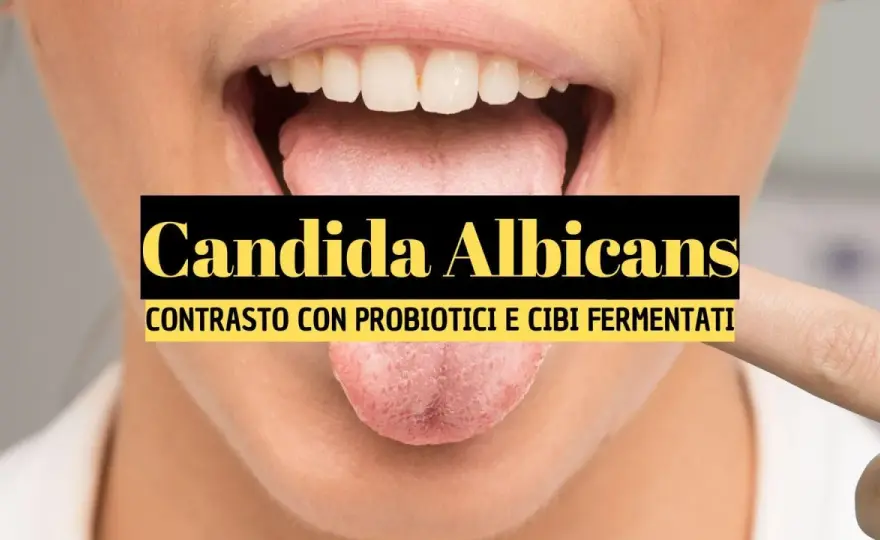 Probiotici e candidosi orale - quando aiutano davvero?