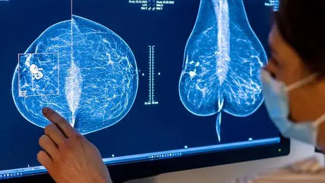 Vorsorge Brustkrebs ab wann: Wichtige Informationen zur Früherkennung