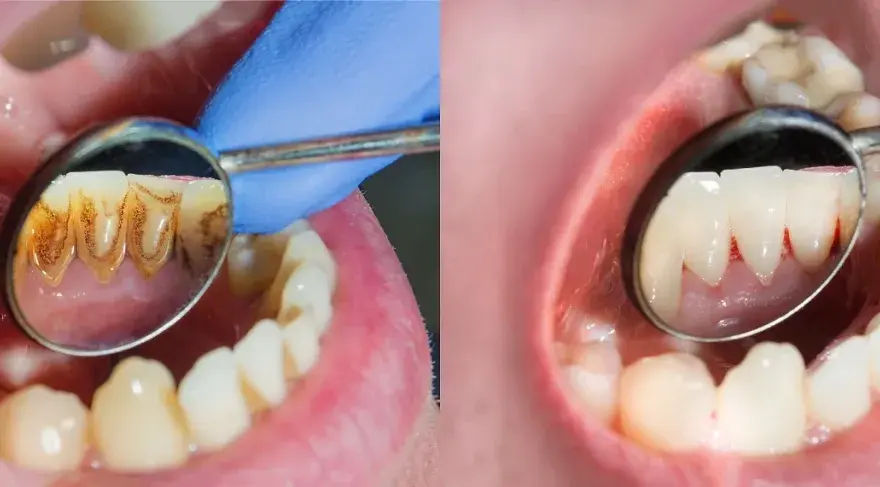 Jak zwracać się do dentysty, aby zyskać jego szacunek i zaufanie