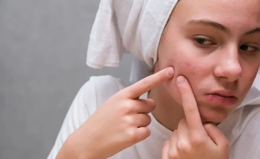 Pryszcz przed ważnym wyjściem? Pozbądź się go w kilka godzin!