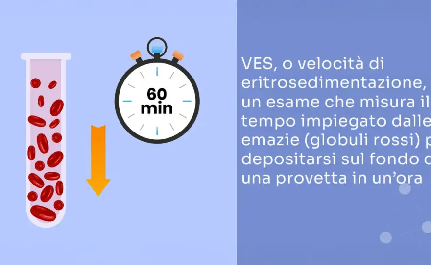 VES alta e infezione ai denti - quando preoccuparsi davvero