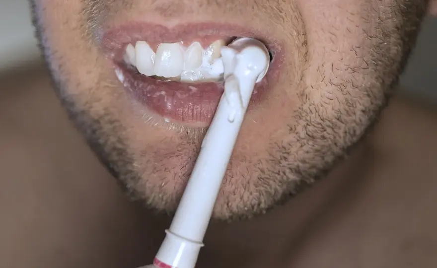 Carie anche se ti lavi i denti? Ecco perché succede