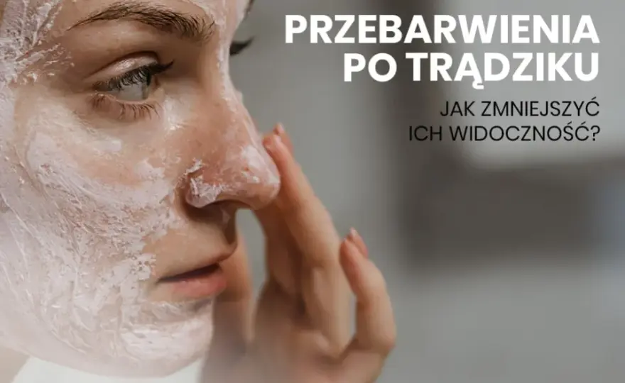 Jak pozbyć się blizn po pryszczach? Domowe i profesjonalne metody