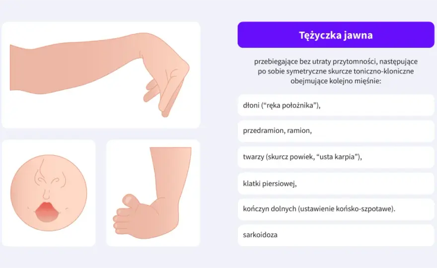 Tężyczka nerwicowa - Czy to lęk, czy niedobór? Sprawdź objawy!
