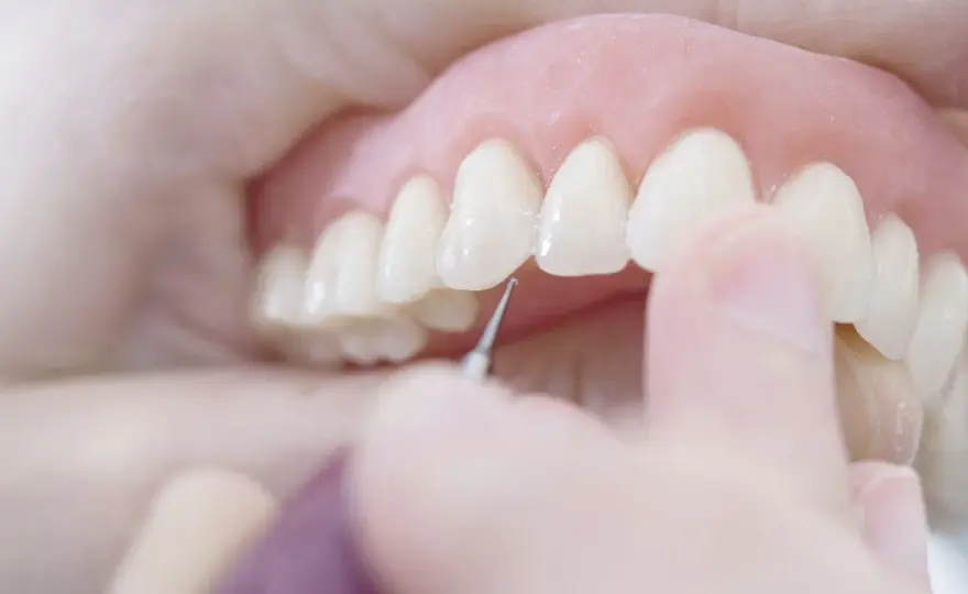 Come abituarsi alla dentiera e gestire dolore e irritazioni
