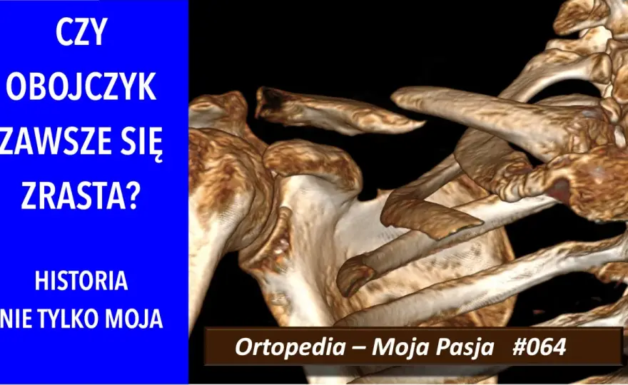 Ile zrasta się kość po złamaniu? Sprawdź typowe czasy