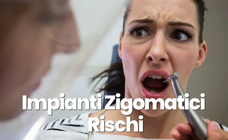 Impianti zigomatici - Rischi reali e come evitarli