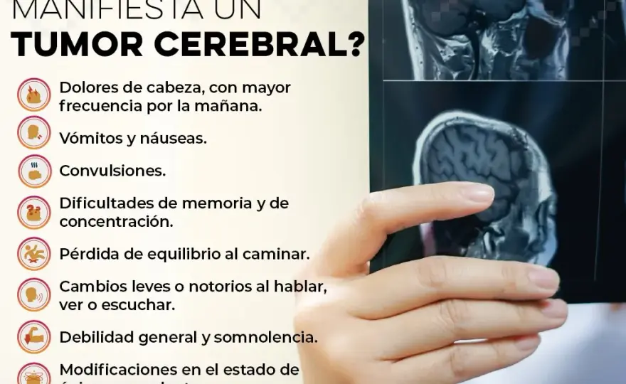 Síntomas de tumor cerebral que no debes ignorar para tu salud