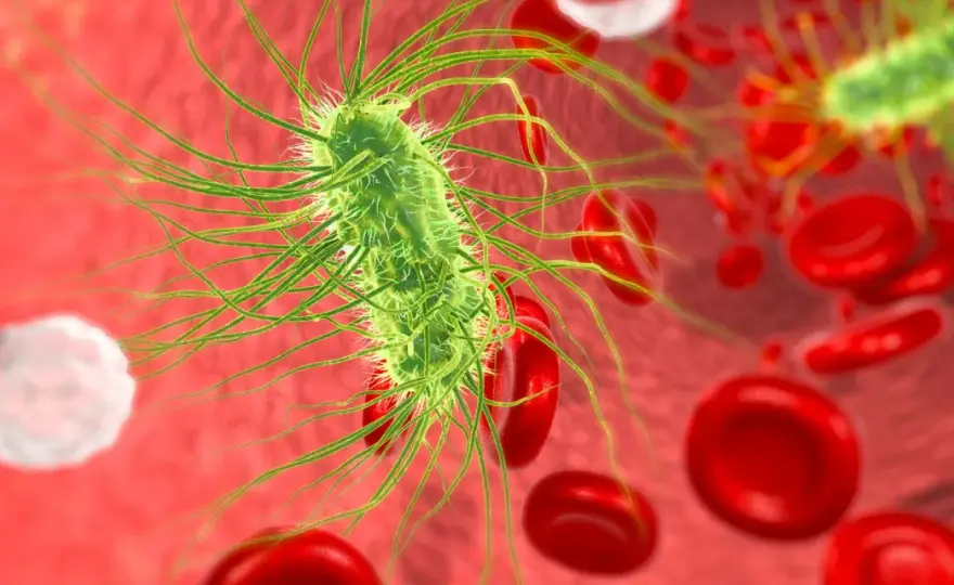 E. coli w moczu - Kiedy leczyć, a kiedy to tylko zanieczyszczenie?