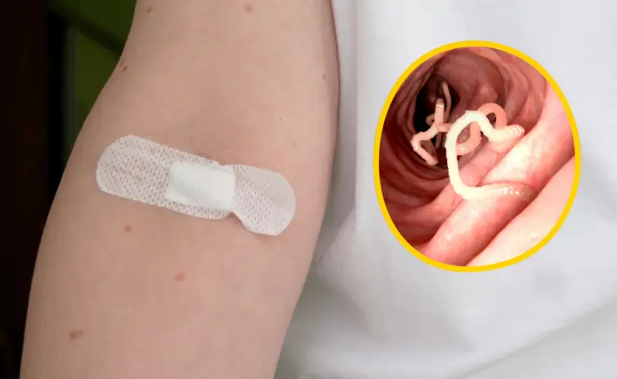 Czy masz pasożyty układu pokarmowego? Objawy, diagnostyka i leczenie