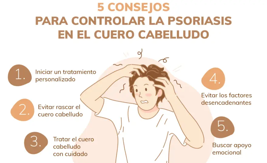 Psoriasis cuero cabelludo - ¿Cómo aliviarla y cuidarlo?