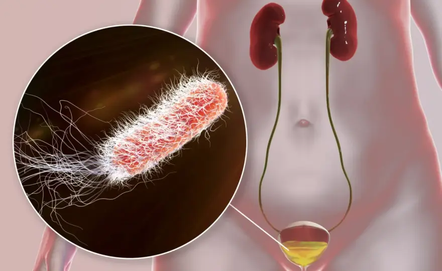 Quels germes causent une infection urinaire et quand consulter ?